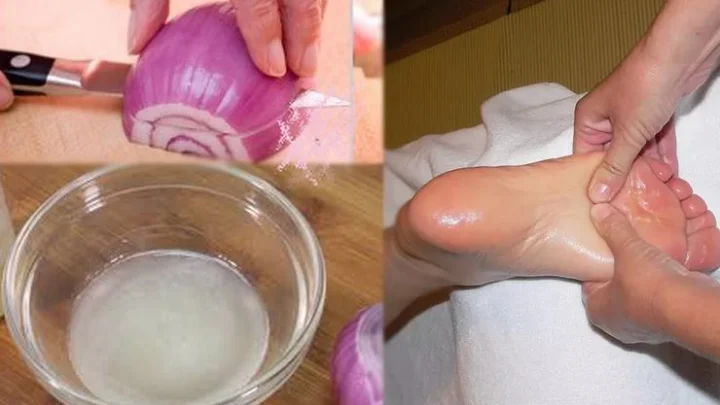 வெங்காயச் சாறு