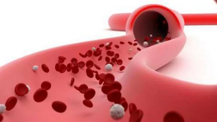 வெள்ளை அணுக்கள்