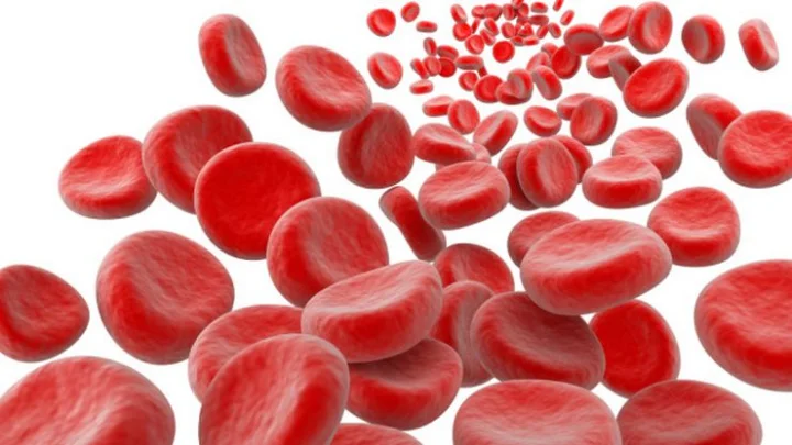 symptoms of Hemoglobin deficiency in child