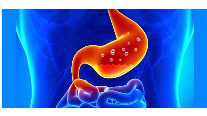 அல்சர் பிரச்சனை