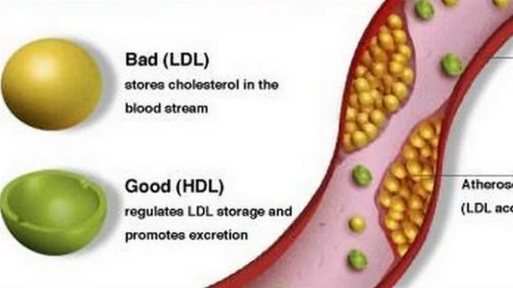 கெட்ட கொழுப்பு