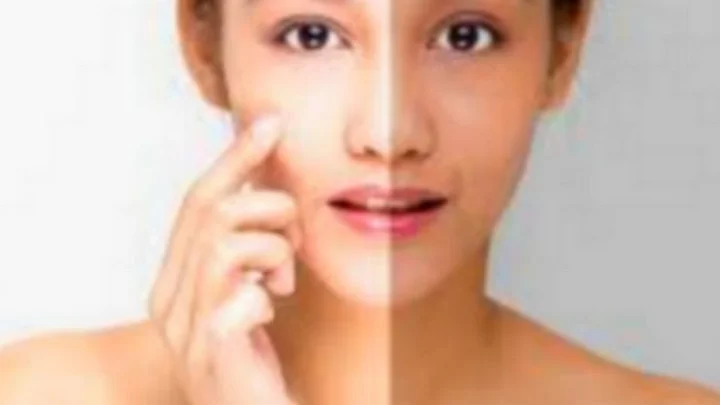 கோடைக்கால கருமை