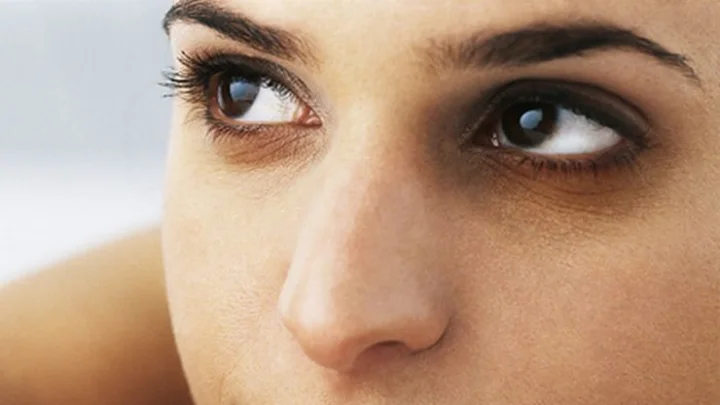 Dark Circles