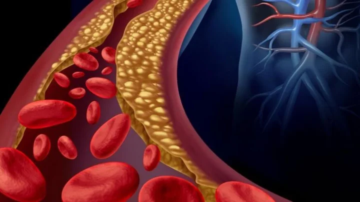 Bad cholesterol