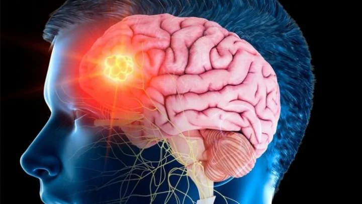 World Brain Tumor Day