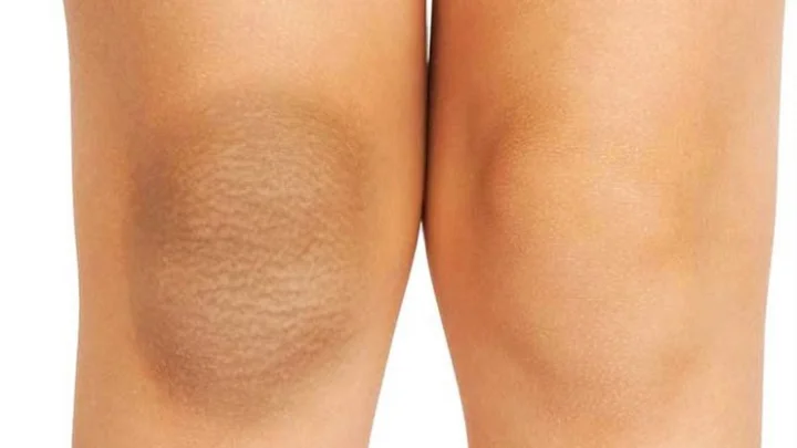Dark Knee