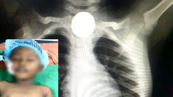 சிறுவன்