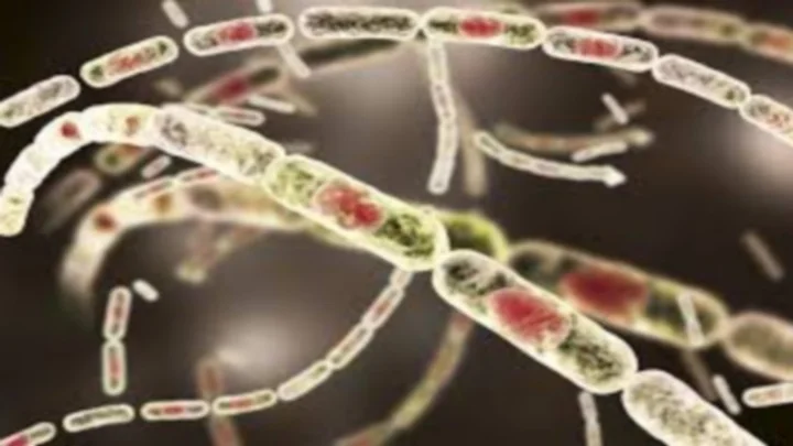 anthrax disease