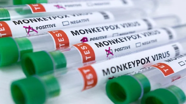Monkeypox in Delhi