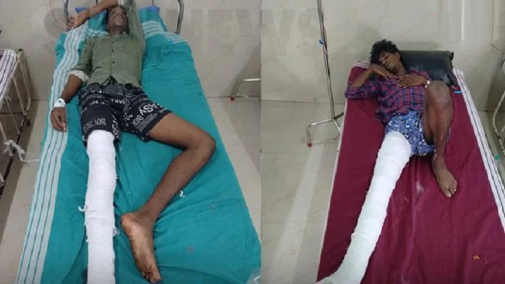 எலும்பு முறிவு