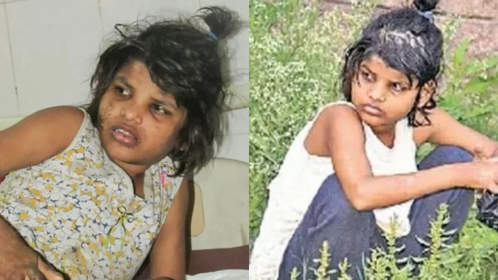 காட்டிலேயே பல வருடங்கள் வளர்ந்த மோக்லி சிறுமி!.. 18 வயதில் மரணம்!..