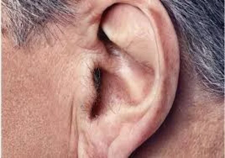 ear roblm