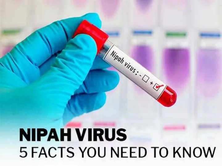 Nipah virus