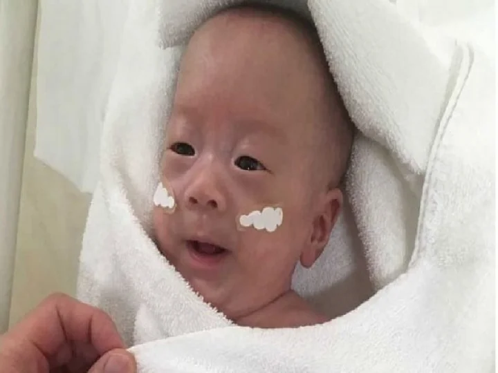 worlds smallest baby