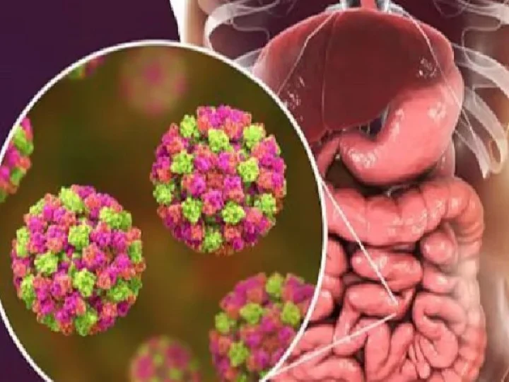 norovirus