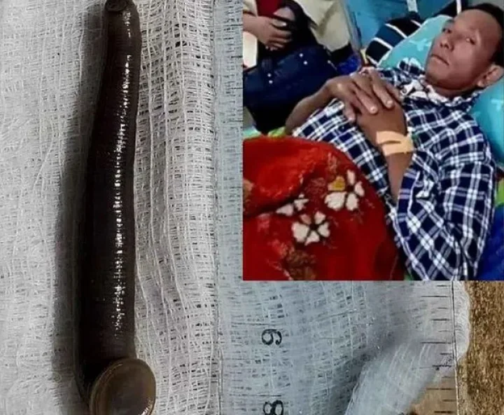 leech stuck in throat