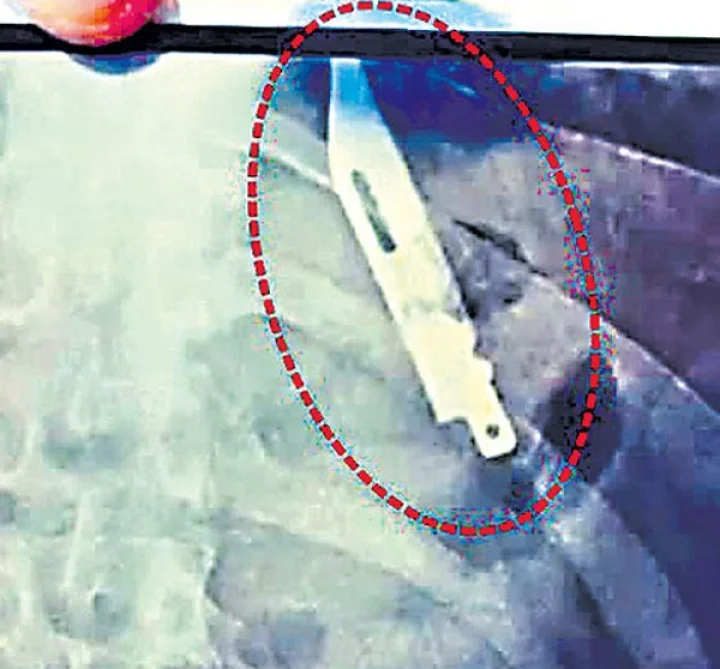 knife in stomach