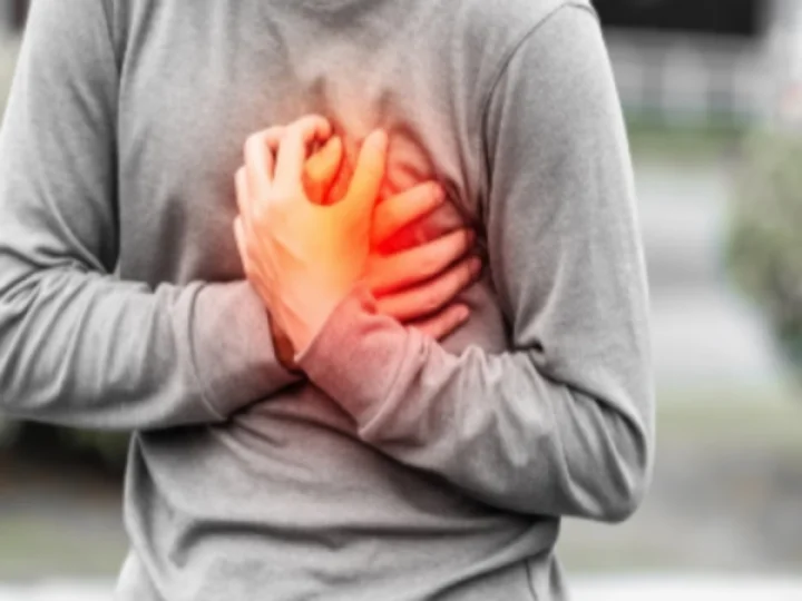 Heart attack
