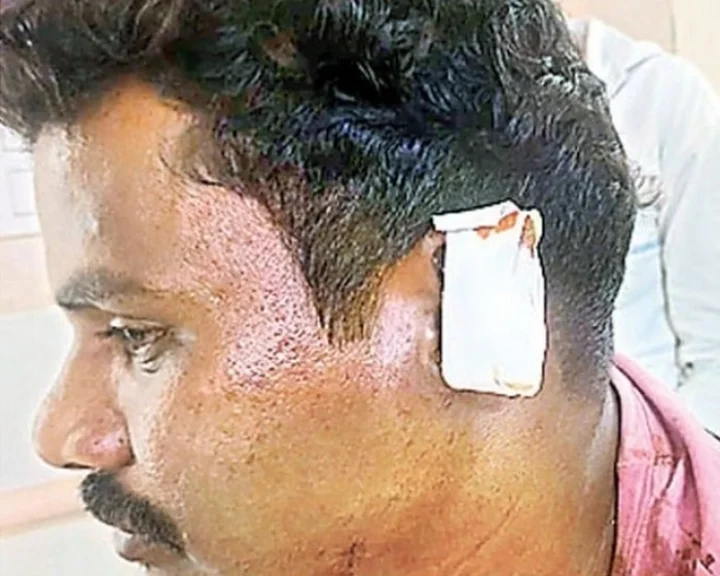 ear cut tdp follower