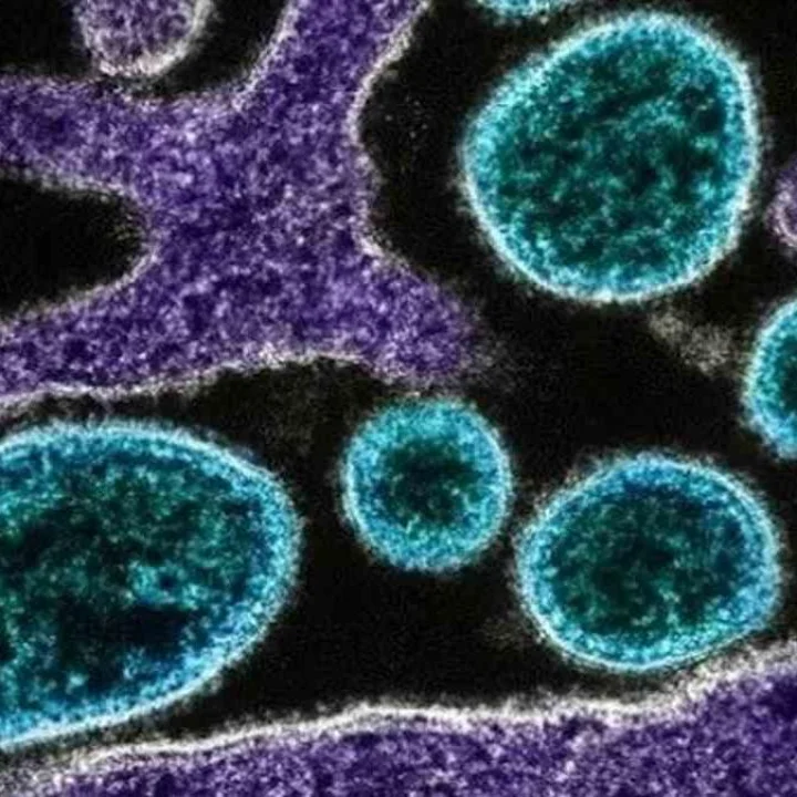 H1N1 Surge Is Seasonal