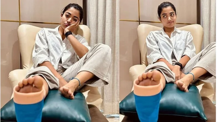 Rashmika responds :గాయాలు కావడం మూడోసారి, దేవుడే రెస్ట్ తీసుకోమన్నాడు : రశ్మిక మందన్న